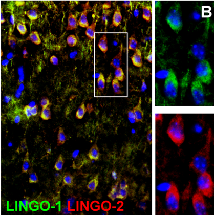 Cibler le récepteur LINGO-1 et ses hétéro-complexes : nouvelles perspectives thérapeutiques pour le traitement des maladies démyélinisantes et neurodégénératives