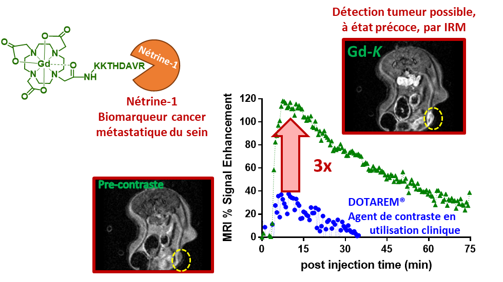 New imaging probe enables MRI detection of early-stage breast cancer tumors