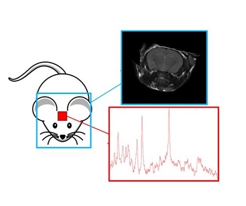 L’IRM (Imagerie par Résonance Magnétique) pour comprendre comment fonctionne notre cerveau