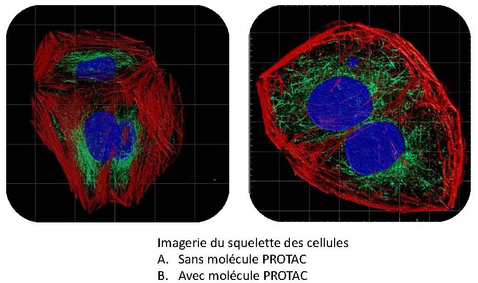 A new anticancer therapeutic strategy targeting the protein kinases LIMKs via new innovative chemical compounds